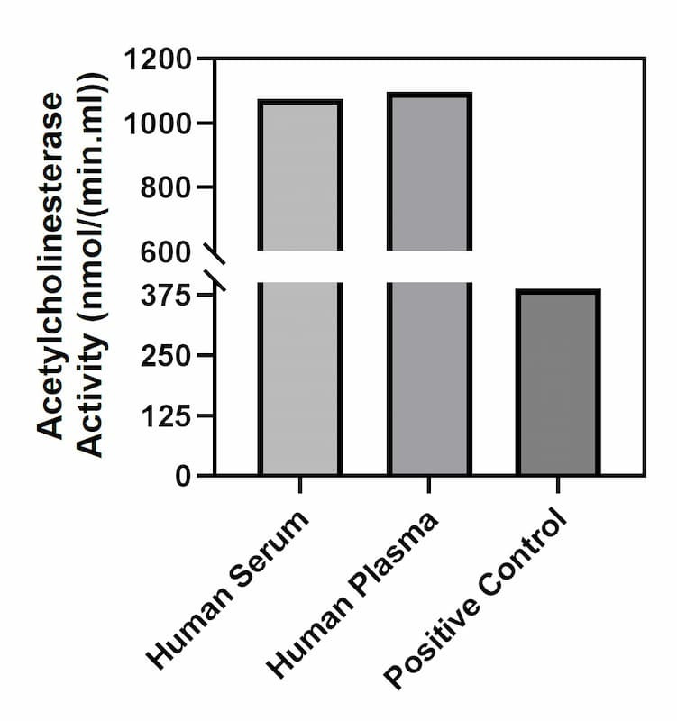 Acetylcholinesterase activity of human serum, human plasma, and positive control.
