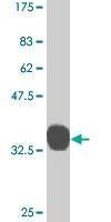 Anti-MSX1 Antibody