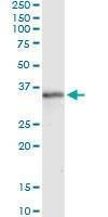 Anti-MSX1 Antibody