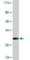 Anti-MTSS1 Antibody