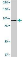 Anti-MTSS1 Antibody