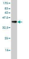 Anti-MUC1 Antibody