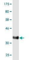 Anti-MUC5AC Antibody