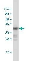Anti-MUTYH Antibody