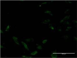 Anti-MUTYH Antibody