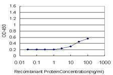 Anti-MYL1 Antibody