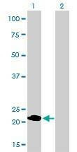 Anti-MYL1 Antibody