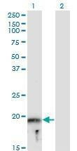 Anti-MYLPF Antibody