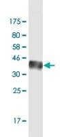 Anti-MYNN Antibody