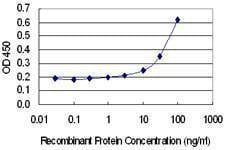 Anti-MYO15A Antibody