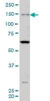 Anti-MYO3A Antibody