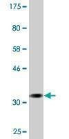 Anti-MYO3A Antibody