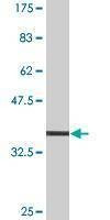 Anti-MYO9A Antibody