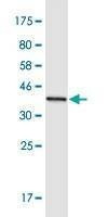 Anti-MYOM1 Antibody