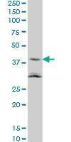 Anti-NAAA Antibody