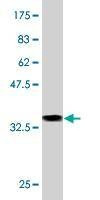 Anti-NAAA Antibody