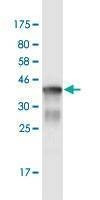 Anti-NCAPG Antibody