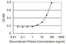 Anti-NCKIPSD Antibody