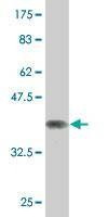 Anti-NCOA4 Antibody