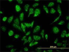 Anti-NCOA4 Antibody