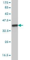 Anti-NDN Antibody
