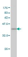 Anti-NCOA6 Antibody