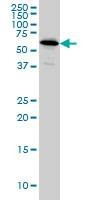 Anti-NDOR1 Antibody