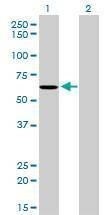 Anti-NDOR1 Antibody