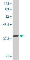 Anti-NDUFA2 Antibody