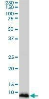 Anti-NDUFB3 Antibody