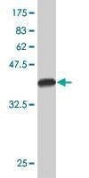 Anti-NDUFB7 Antibody