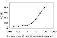 Anti-NDUFB7 Antibody