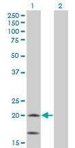Anti-NDUFS4 Antibody