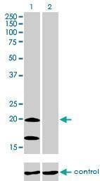 Anti-NDUFS4 Antibody