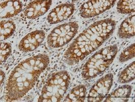 Anti-NDUFS4 Antibody