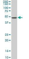 Anti-NEK2 Antibody