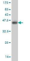 Anti-NEK2 Antibody