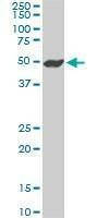 Anti-NEK2 Antibody