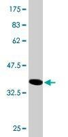 Anti-NEK4 Antibody