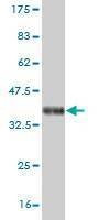 Anti-NEUROG1 Antibody