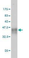 Anti-NF1 Antibody