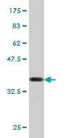 Anti-NFATC2 Antibody