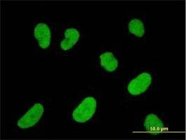 Anti-NFATC2IP Antibody