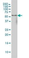 Anti-NFIC Antibody