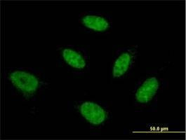 Anti-NFYB Antibody