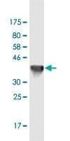 Anti-NHS Antibody