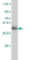 Anti-NISCH Antibody