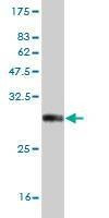 Anti-NKX3-1 Antibody