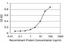 Anti-NKX3-1 Antibody