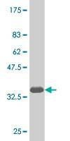 Anti-NKX6-1 Antibody